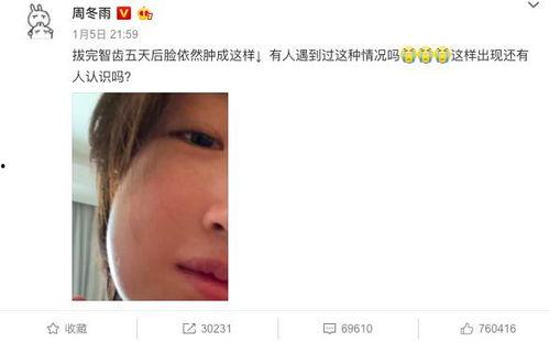 周冬雨吃瓜歌单,她的“吃瓜”音乐之旅